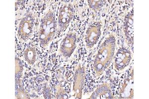 IHC analysis of IFIT5 using anti-IFIT5 antibody (ABIN7600752). (IFIT5 anticorps  (AA 23-439))