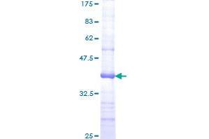 Image no. 1 for MutS Homolog 6 (E. Coli) (MSH6) (AA 931-1030) protein (GST tag) (ABIN1311444)