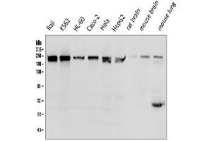 Western blot analysis of BRG1 using anti-BRG1 antibody (ABIN7602029).
