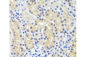 Immunohistochemistry of paraffin-embedded Mouse kidney using INADL Polyclonal Antibody at dilution of 1:100 (40x lens). (PATJ anticorps)