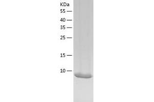 Western Blotting (WB) image for Eukaryotic Translation Initiation Factor 4E Binding Protein 3 (EIF4EBP3) (AA 1-100) protein (His-IF2DI Tag) (ABIN7122854)