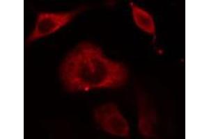 ABIN6274657 staining Hela cells by IF/ICC. (Cytochrome P450 3A4, 3A5 anticorps)