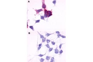 Immunocytochemistry (ICC) staining of HEK293 human embryonic kidney cells transfected (A) or untransfected (B) with P2RY6. (P2RY6 anticorps  (C-Term))