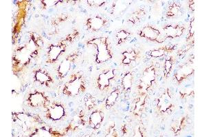 Immunohistochemistry of paraffin-embedded mouse kidney using Clathrin heavy chain Rabbit mAb (ABIN7266404) at dilution of 1:100 (40x lens).