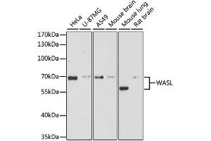 Western blot analysis of extracts of various cell lines, using WASL antibody. (Neural Wiskott-Aldrich syndrome protein (WASL) anticorps)