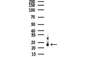 Western blot analysis of lysates from Mouse liver, using NOL3 Antibody at 1/1000 dilution.