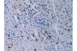 Figure. (TPSAB1 anticorps  (AA 161-262))