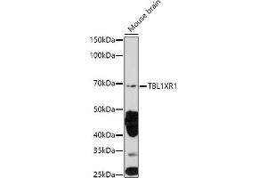Western blot analysis of extracts of Mouse brain, using TBL1XR1 antibody (ABIN6132717, ABIN6148893, ABIN6148895 and ABIN6217436) at 1:1000 dilution. (TBL1XR1 anticorps  (AA 1-180))