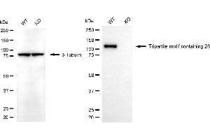 Western blotting analysis using tripartite motif containing 28 antibody (ABIN7800631).