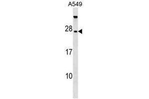 TBC1D28 Antibody (Center) western blot analysis in A549 cell line lysates (35µg/lane). (TBC1D28 anticorps  (Middle Region))