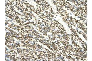 Rabbit Anti-TAF7 antibody   Paraffin Embedded Tissue: Human Heart cell Cellular Data: cardiac cell of renal tubule Antibody Concentration: 4.