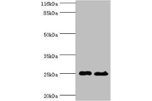 Western blot All lanes: Calcineurin B homologous protein 3 antibody at 2 μg/mL Lane 1: Hela whole cell lysate Lane 2: Mouse brain tissue Secondary Goat polyclonal to rabbit at 1/10000 dilution Predicted band size: 25, 19, 22 kDa Observed band size: 25 kDa (Tescalcin anticorps  (AA 2-214))