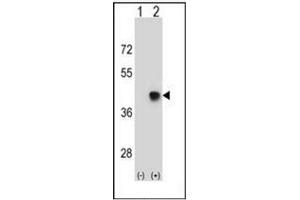 Western blot analysis of SPEM1 (arrow) using SPEM1 Antibody (Center) Cat. (SPEM1 anticorps  (Middle Region))