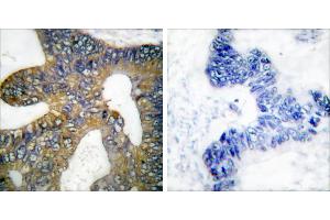 Peptide - +Immunohistochemical analysis of paraffin-embedded human colon carcinoma tissue using HSP105 antibody (#C0231). (HSPH1 anticorps)
