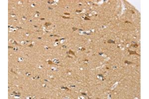The image on the left is immunohistochemistry of paraffin-embedded Human brain tissue using ABIN7192337(SEZ6L Antibody) at dilution 1/30, on the right is treated with synthetic peptide. (SEZ6L anticorps)