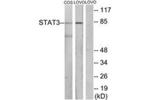 Western blot analysis of extracts from LOVO/COS7 cells, using STAT3 Antibody. (STAT3 anticorps  (AA 656-705))