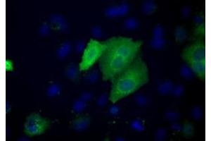Image no. 3 for anti-Acetyl-CoA Acetyltransferase 2 (ACAT2) antibody (ABIN1496400) (ACAT2 anticorps)