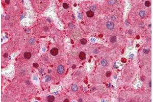 Human Liver: Formalin-Fixed, Paraffin-Embedded (FFPE)