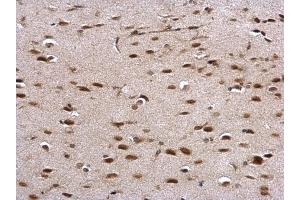 IHC-P Image PRP antibody detects PRP protein at nucleus on mouse middle brain by immunohistochemical analysis.