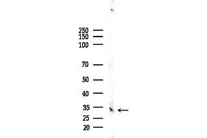 Western blot analysis of lysates from EC304 cells, using OR51E2 Antibody at 1/1000 dilution.