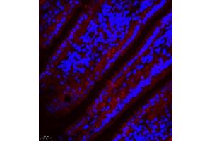 Immunofluorescence of paraffin embedded mouse small intestine using SLC7A8 (ABIN7074503) at dilution of 1:300 (400x lens)
