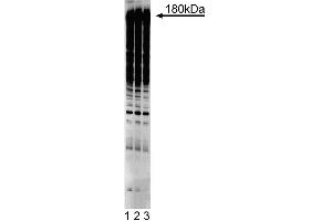 Western blot analysis of phosphotyrosine on A431 cell lysate.