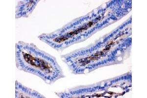 IHC analysis of CD9 using anti-CD9 antibody (ABIN4886531). (CD9 anticorps  (AA 110-193))