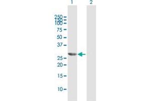 Western Blot analysis of HOXB9 expression in transfected 293T cell line by HOXB9 MaxPab polyclonal antibody.