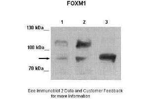 Lanes:   Lane 1: 25ug MIA PaCa-2 human pancreatic cancer cell line Lane 2: 25ug MDA-MB-231 cell lysate Lane 3: 25ug Huh-7 cell lysate  Primary Antibody Dilution:   1:2000  Secondary Antibody:   Anti-rabbit-HRP  Secondary Antibody Dilution:   1:5000  Gene Name:   FOXM1  Submitted by:   Andrei L. (FOXM1 anticorps  (Middle Region))