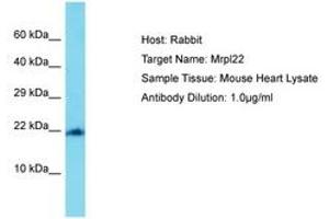 Image no. 1 for anti-Mitochondrial Ribosomal Protein L22 (MRPL22) (AA 108-157) antibody (ABIN6750490) (MRPL22 anticorps  (AA 108-157))