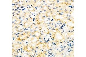 Immunohistochemistry of paraffin embedded mouse kidney using CYP20A1 (ABIN7073675) at dilution of 1: 700 (400x lens)