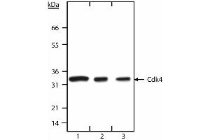 Western blot analysis of Cdk4. (CDK4 anticorps  (N-Term))