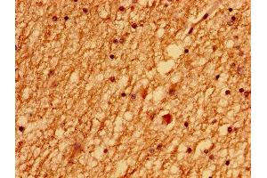 Immunohistochemistry of paraffin-embedded human brain tissue using ABIN7174184 at dilution of 1:100 (LSM1 anticorps  (AA 1-133))