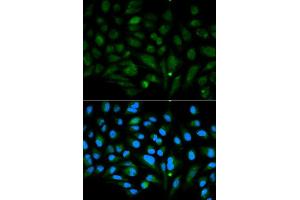 Immunofluorescence analysis of MCF7 cell using DCN antibody. (Decorin anticorps  (AA 31-359))