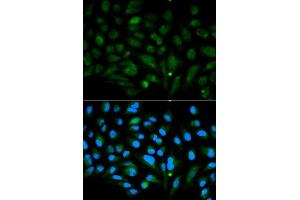 Immunofluorescence analysis of MCF7 cell using DCN antibody.