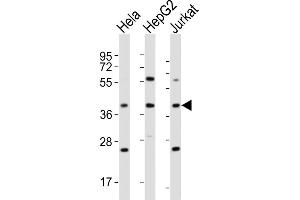 All lanes : Anti-OR5M9 Antibody (C-term) at 1:4000 dilution Lane 1: Hela whole cell lysates Lane 2: HepG2 whole cell lysates Lane 3: Jurkat whole cell lysates Lysates/proteins at 20 μg per lane. (OR5M9 anticorps  (C-Term))