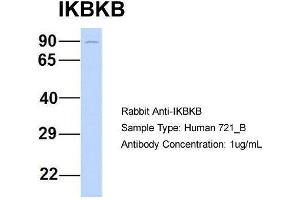 Host: Rabbit Target Name: IKBKB Sample Type: Human 721_B Antibody Dilution: 1. (IKBKB anticorps  (N-Term))