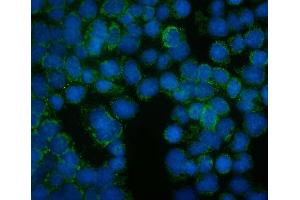 IF analysis of FRMD6 using anti-FRMD6 antibody (ABIN7599577). (FRMD6 anticorps  (AA 1-95))