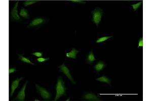 Immunofluorescence of monoclonal antibody to FNTB on HeLa cell.