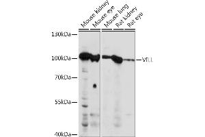 Western blot analysis of extracts of various cell lines, using VILL Rabbit pAb (ABIN7271325) at 1:1000 dilution. (VILL anticorps  (AA 637-856))