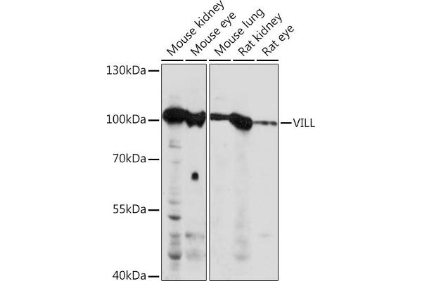 VILL Antikörper  (AA 637-856)