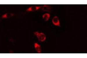 ABIN6269237 staining HeLa cells by IF/ICC. (CD130/gp130 anticorps  (C-Term))