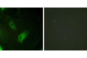 Peptide - +Immunohistochemistry analysis of paraffin-embedded human ovary tissue using IREB1 antibody. (Aconitase 1 anticorps  (Internal Region))