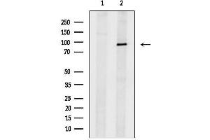 Western blot analysis of lysates from 3, using TRPC1 Antibody.