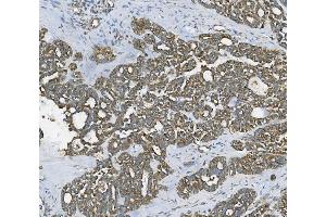IHC analysis of RAB1B using anti-RAB1B antibody (ABIN7602809). (RAB1B anticorps  (C-Term))