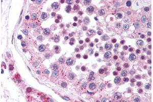 anti-Discoidin, CUB and LCCL Domain Containing 2 (DCBLD2) (AA 399-416) antibody