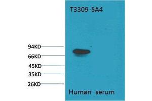 Western Blot (WB) analysis of Human Serum with Transferrin Mouse Monoclonal Antibody diluted at 1:2000. (Transferrin anticorps)
