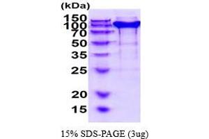 SDS-PAGE (SDS) image for Neuropilin 1 (NRP1) (AA 22-856) protein (His tag) (ABIN6387813)