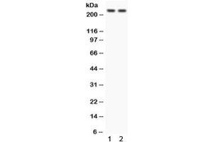 Western blot testing of 1) rat heart and 2) human 293 lysate with Otoferlin antibody. (Otoferlin anticorps)