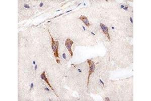 Immunohistochemical analysis of paraffin-embedded human brain using AURKA antibody at 1:25 dilution. (Aurora A anticorps)